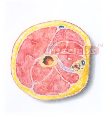 HUMAN TRANSVERSE SECTION MODEL THROUGH THE PORXIMAL 1/3 OF THE RIGHT ARM (A)